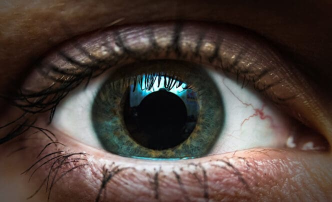 Dilated Pupils (Mydriasis): What Is It, Causes & What It Looks Like