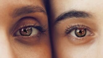 two women dry eyes