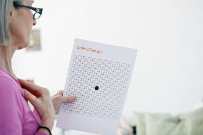 Amsler grid eye test of right (on the right) and left (on the left