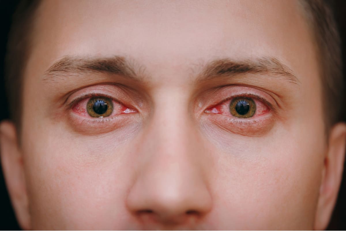 9-things-doctors-can-tell-about-your-health-just-by-looking-at-your-eyes