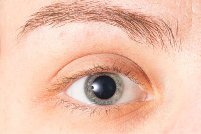 mydriasis pupil dilation