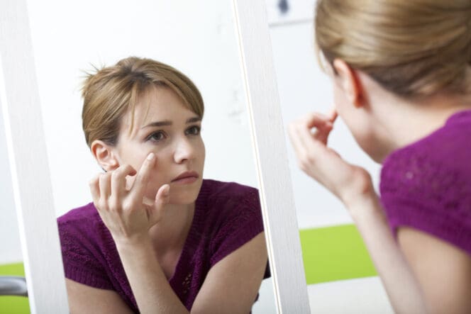 woman with puffy eyes