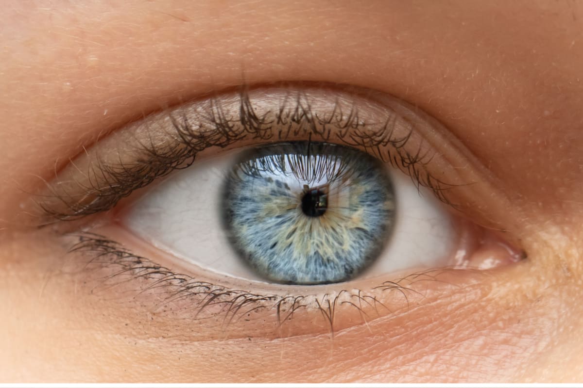 Miosis Constricted Pupils Causes And When To See A Doctor MyVision Org