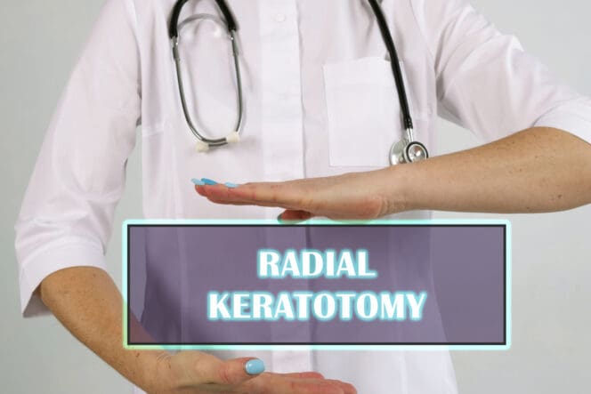 radial keratotomy