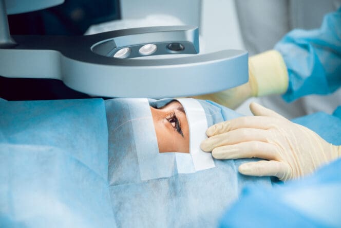 woman getting refractive lens exchange