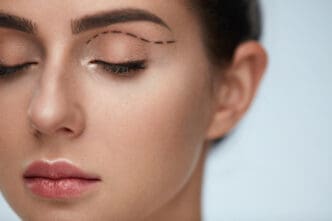 woman prepping for blepharoplasty eyelid surgery
