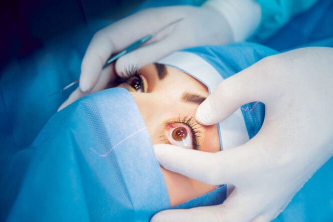 Enucleation of the eye