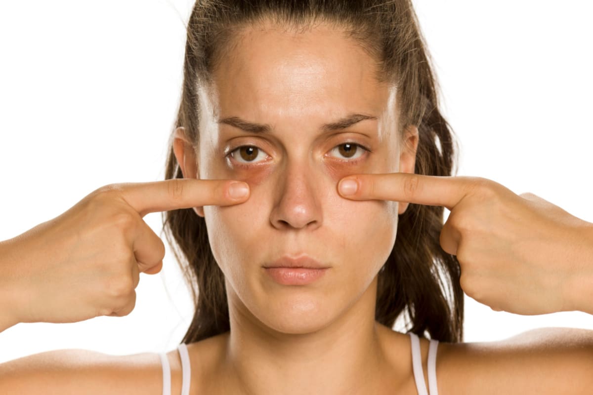 Under Eye Bags, Puffiness Under the Eyes Causes - Dr. U