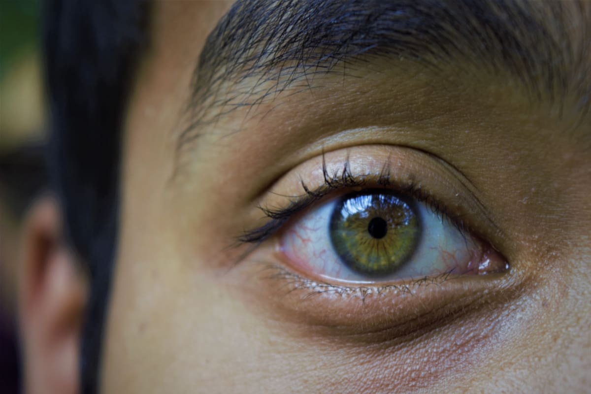 Hazel Eye Color Rare Hazel Eyes: Advantages, Disadvantages & More | MyVision.org