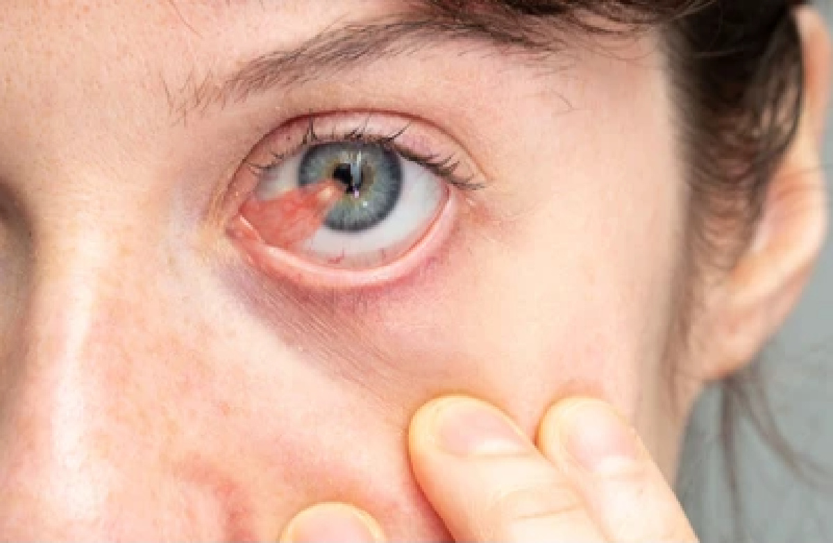 Bubble on Eyeball: Causes, Diagnosis & Treatment | MyVision.org